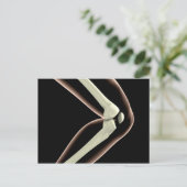 RöntgenAfbeelding van knie 1 Briefkaart (Staand voorkant)