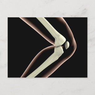 RöntgenAfbeelding van knie 1 Briefkaart