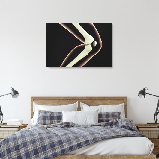 RöntgenAfbeelding van knie 1 Canvas Afdruk (Insitu (Slaapkamer))