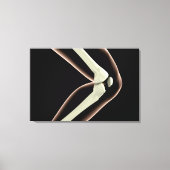 RöntgenAfbeelding van knie 1 Canvas Afdruk (Voorkant)