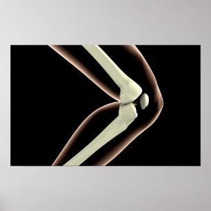 RöntgenAfbeelding van knie 1 Poster