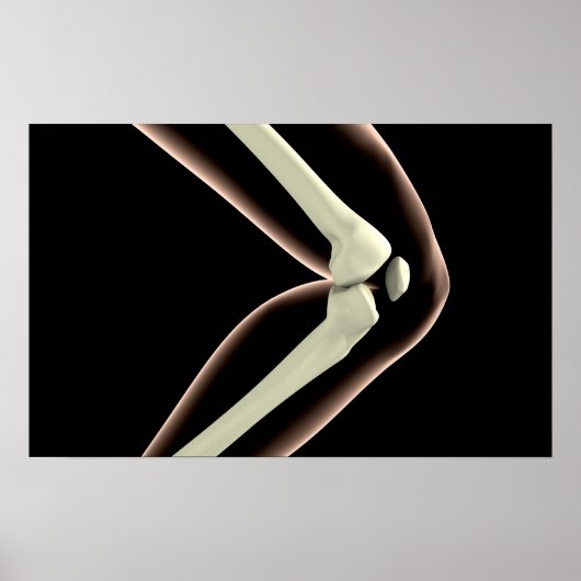 RöntgenAfbeelding van knie 1 Poster (Voorkant)