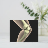 RöntgenAfbeelding van knie 2 Briefkaart (Staand voorkant)