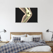 RöntgenAfbeelding van knie 2 Canvas Afdruk (Insitu (Slaapkamer))