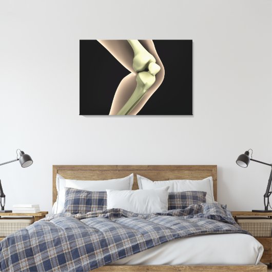 RöntgenAfbeelding van knie 2 Canvas Afdruk (Insitu (Slaapkamer))