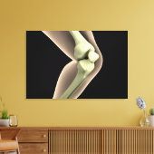 RöntgenAfbeelding van knie 2 Canvas Afdruk (Insitu (Woonkamer))
