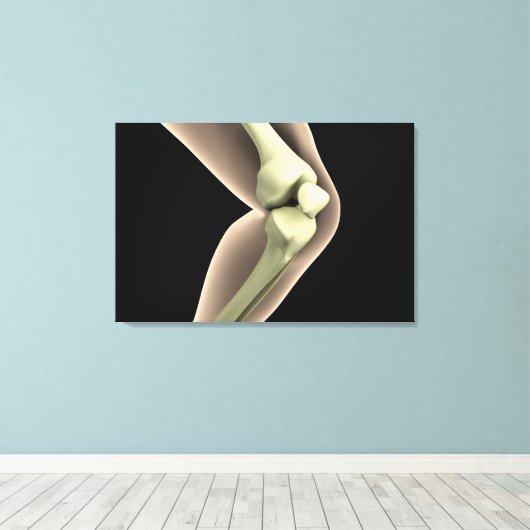 RöntgenAfbeelding van knie 2 Canvas Afdruk (Insitu (Houten vloer))