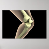 RöntgenAfbeelding van knie 2 Poster (Voorkant)