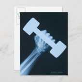 Röntgenafbeelding van menselijke hand met gewicht, briefkaart (Voorkant / Achterkant)