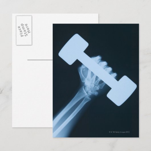 Röntgenafbeelding van menselijke hand met gewicht, briefkaart (Voorkant / Achterkant)