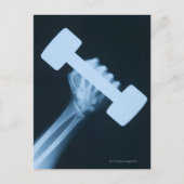 Röntgenafbeelding van menselijke hand met gewicht, briefkaart (Voorkant)