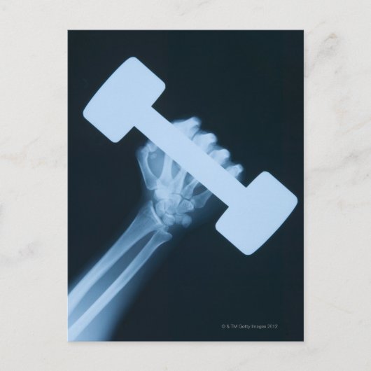 Röntgenafbeelding van menselijke hand met gewicht, briefkaart (Voorkant)