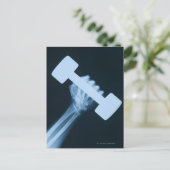 Röntgenafbeelding van menselijke hand met gewicht, briefkaart (Staand voorkant)