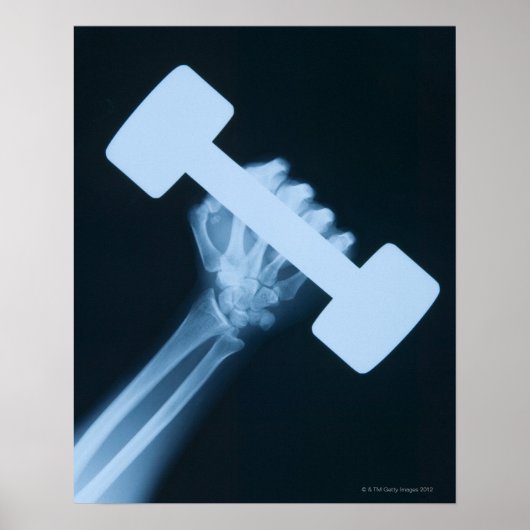Röntgenafbeelding van menselijke hand met gewicht, poster (Voorkant)