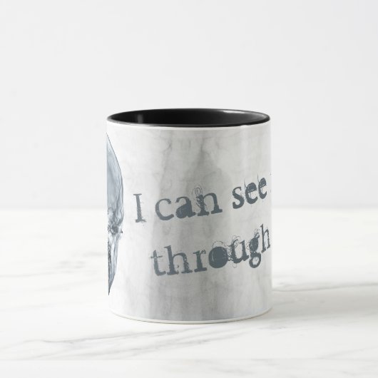 Röntgenanatomische schedel radiologie mok (Midden)