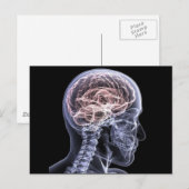 Röntgenbrein Briefkaart (Voorkant / Achterkant)