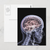 Röntgenbrein Briefkaart (Voorkant / Achterkant)