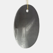 röntgenfoto keramisch ornament (Rechts)