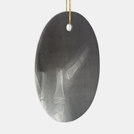 röntgenfoto keramisch ornament (Rechts)