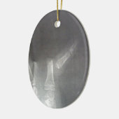 röntgenfoto keramisch ornament (Links)