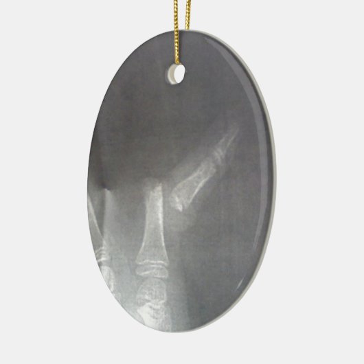 röntgenfoto keramisch ornament (Links)