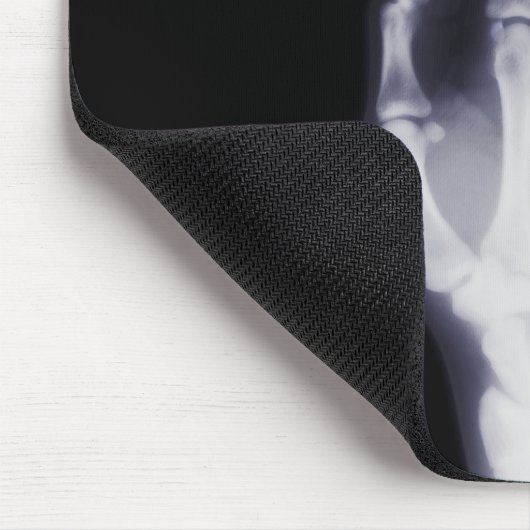 röntgenfoto muismat (Hoek)