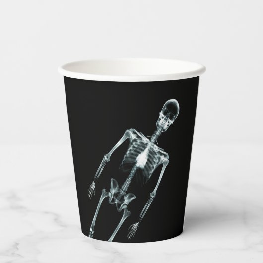 Röntgenfoto skelet papieren bekers (Achterkant)