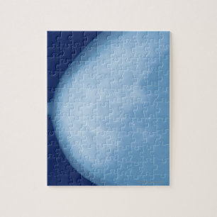 Röntgenfoto van borst van vrouwen, uitzicht aan d legpuzzel