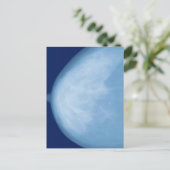 Röntgenfoto van borst van vrouwen, uitzicht aan de briefkaart (Staand voorkant)