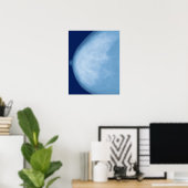 Röntgenfoto van borst van vrouwen, uitzicht aan de poster (Thuiskantoor)