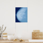 Röntgenfoto van borst van vrouwen, uitzicht aan de poster (Keuken)