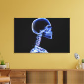 röntgenfoto van de botten in de nek canvas afdruk (Insitu (Woonkamer))