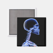 röntgenfoto van de botten in de nek magneet (Voorkant / Achterkant)