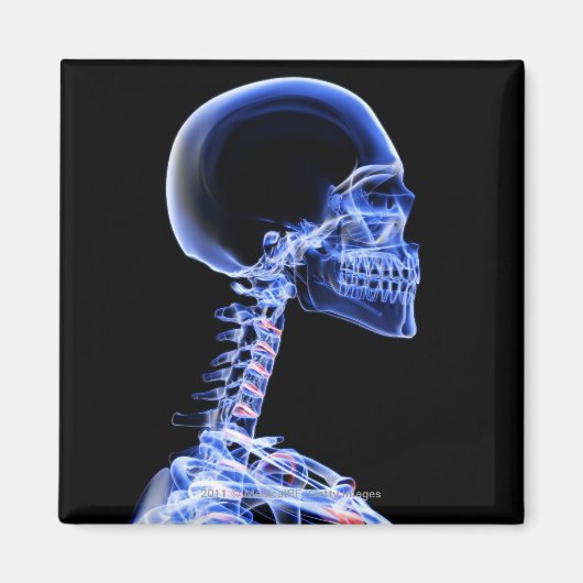 röntgenfoto van de botten in de nek magneet (Voorkant)