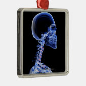 röntgenfoto van de botten in de nek metalen ornament (Rechts)