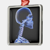 röntgenfoto van de botten in de nek metalen ornament (Links)