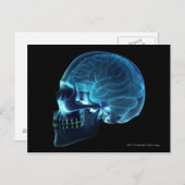 Röntgenfoto van de hersenen in een schedel briefkaart (Voorkant / Achterkant)