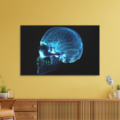 Röntgenfoto van de hersenen in een schedel canvas afdruk (Insitu (Woonkamer))