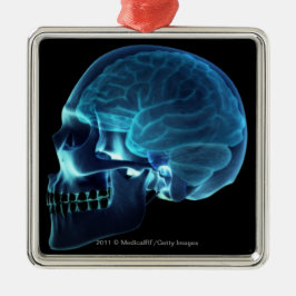 Röntgenfoto van de hersenen in een schedel metalen ornament