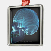 Röntgenfoto van de hersenen in een schedel metalen ornament (Links)