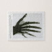 Röntgenfoto van de zestigste hand Puzzle Legpuzzel (Horizontaal)