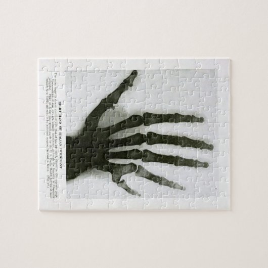 Röntgenfoto van de zestigste hand Puzzle Legpuzzel (Horizontaal)