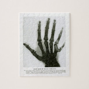 Röntgenfoto van de zestigste hand Puzzle Legpuzzel