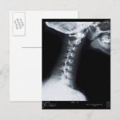 Röntgenfoto van halswervels inclusief onderkaak briefkaart (Voorkant / Achterkant)