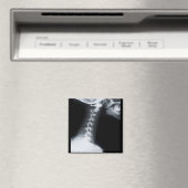 Röntgenfoto van halswervels inclusief onderkaak magneet (Insitu (Vaatwasser))