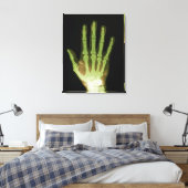 Röntgenfoto van hand van mens canvas afdruk (Insitu (Slaapkamer))