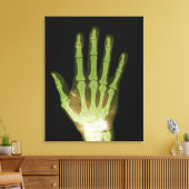 Röntgenfoto van hand van mens canvas afdruk (Insitu (Woonkamer))
