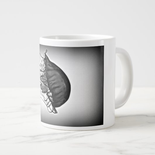 röntgenfoto van kwallen grote koffiekop (Voorkant rechts)