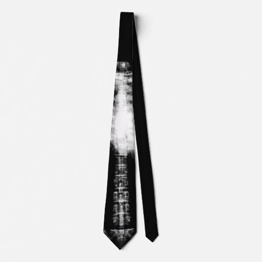 Röntgenfoto van skeletribben en wervelkolom stropdas (Voorkant)