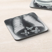 Röntgenfoto van vlinders in de maag bier onderzetter (Linkerzijde)